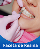 Faceta de Resina Contagem no Eldorado