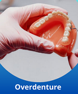 Overdenture Contagem no Eldorado